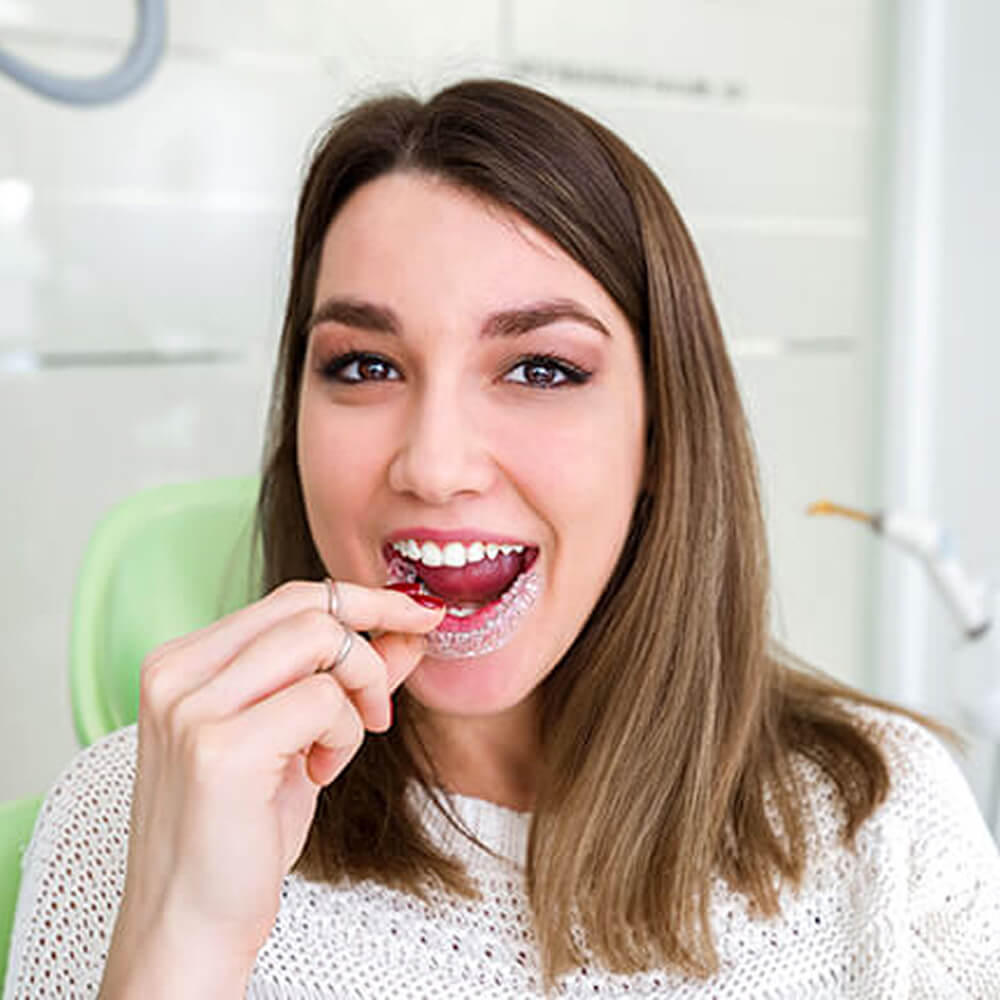Clear Aligner Treatment